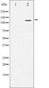 NFAT4 / NFATC3 Antibody - Western blot analysis of NFAT4 expression in HeLa whole cells lysates. The lane on the left is treated with the antigen-specific peptide.