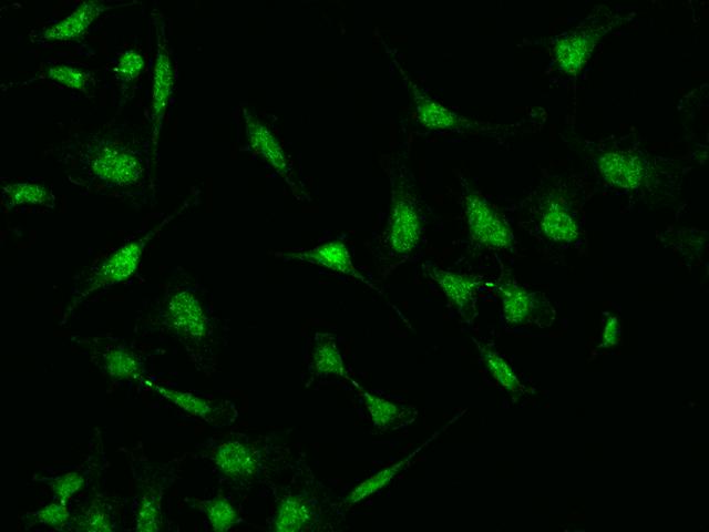 NFAT4 / NFATC3 Antibody - Immunofluorescence staining of NFATC3 in HeLa cells. Cells were fixed with 4% PFA, permeabilzed with 0.1% Triton X-100 in PBS, blocked with 10% serum, and incubated with rabbit anti-Human NFATC3 polyclonal antibody (dilution ratio 1:1000) at 4°C overnight. Then cells were stained with the Alexa Fluor 488-conjugated Goat Anti-rabbit IgG secondary antibody (green).