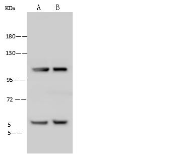NFAT4 / NFATC3 Antibody - Anti-NFATC3 rabbit polyclonal antibody at 1:500 dilution. Lane A: HeLa Whole Cell Lysate. Lane B: Jurkat Whole Cell Lysate. Lysates/proteins at 30 ug per lane. Secondary: Goat Anti-Rabbit IgG (H+L)/HRP at 1/10000 dilution. Developed using the ECL technique. Performed under reducing conditions. Predicted band size: 115 kDa.
