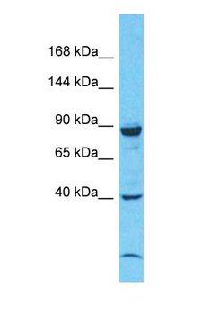 NFAT4 / NFATC3 Antibody - Western blot of NFATC3 Antibody with human COLO205 Whole Cell lysate.  This image was taken for the unconjugated form of this product. Other forms have not been tested.