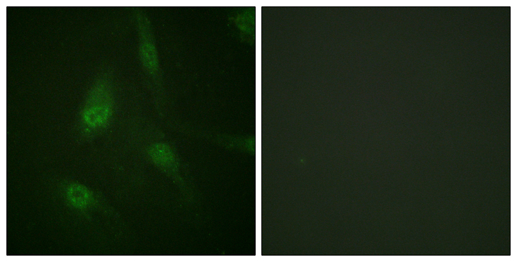 NFAT4 / NFATC3 Antibody - Immunofluorescence analysis of HeLa cells, using NFAT4 (Phospho-Ser165) Antibody. The picture on the right is blocked with the phospho peptide.