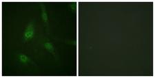 NFAT4 / NFATC3 Antibody - Immunofluorescence analysis of HeLa cells, using NFAT4 (Phospho-Ser165) Antibody. The picture on the right is blocked with the phospho peptide.