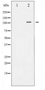 NFAT4 / NFATC3 Antibody - Western blot of NFAT4 phosphorylation expression in HeLa whole cell lysates,The lane on the left is treated with the antigen-specific peptide.