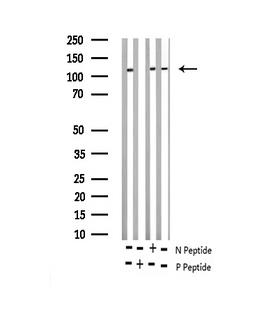 NFAT4 / NFATC3 Antibody - Western blot analysis of Phospho-NFAT4 (Ser165) expression in various lysates