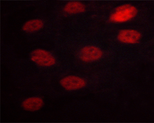 NFAT4 / NFATC3 Antibody - Staining HeLa cells by IF/ICC. The samples were fixed with PFA and permeabilized in 0.1% saponin prior to blocking in 10% serum for 45 min at 37°C. The primary antibody was diluted 1/400 and incubated with the sample for 1 hour at 37°C. A Alexa Fluor 594 conjugated goat polyclonal to rabbit IgG (H+L), diluted 1/600 was used as secondary antibody.