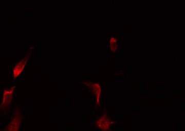 NFAT4 / NFATC3 Antibody - Staining HeLa cells by IF/ICC. The samples were fixed with PFA and permeabilized in 0.1% Triton X-100, then blocked in 10% serum for 45 min at 25°C. The primary antibody was diluted at 1:200 and incubated with the sample for 1 hour at 37°C. An Alexa Fluor 594 conjugated goat anti-rabbit IgG (H+L) Ab, diluted at 1/600, was used as the secondary antibody.