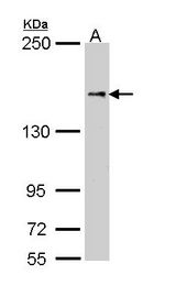 NFAT5 Antibody - Sample (30 ug of whole cell lysate). A: Molt-4. 5% SDS PAGE. NFAT5 antibody diluted at 1:1000. 