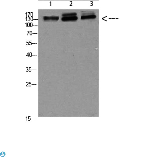 NFAT5 Antibody - Western blot analysis of 823, 293T-UV and HELA Cell Lysate, antibody was diluted at 1:1000. Secondary antibody was diluted at 1:20000.