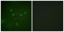 NFAT5 Antibody - Immunofluorescence analysis of COS7 cells, using NFAT5 (Phospho-Ser1197) Antibody. The picture on the right is blocked with the phospho peptide.