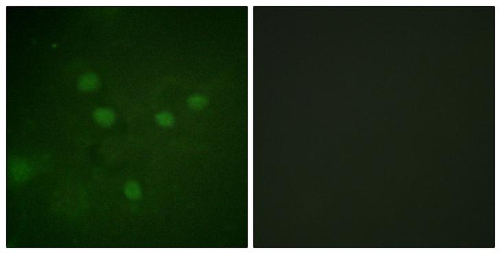 NFAT5 Antibody - P-peptide - + Immunofluorescence analysis of COS7 cells, using NFAT5 (Phospho-Ser1197) antibody. NFAT5 (Phospho-Ser1197) antibody reacts with epitope-specific phosphopeptide and corresponding non-phosphopeptide.