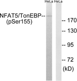 NFAT5 Antibody - Western blot analysis of lysates from HeLa cells treated with forskolin 40nM 30', using NFAT5/TonEBP (Phospho-Ser155) Antibody. The lane on the right is blocked with the phospho peptide.
