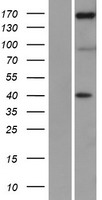 NFAT5 Protein - Western validation with an anti-DDK antibody * L: Control HEK293 lysate R: Over-expression lysate