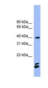 NFATC1 / NFAT2 Antibody - NFATC1 antibody Western blot of Fetal Brain lysate. This image was taken for the unconjugated form of this product. Other forms have not been tested.