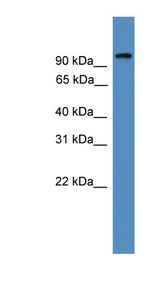 NFATC1 / NFAT2 Antibody - NFATC1 antibody Western blot of Fetal Brain lysate. This image was taken for the unconjugated form of this product. Other forms have not been tested.