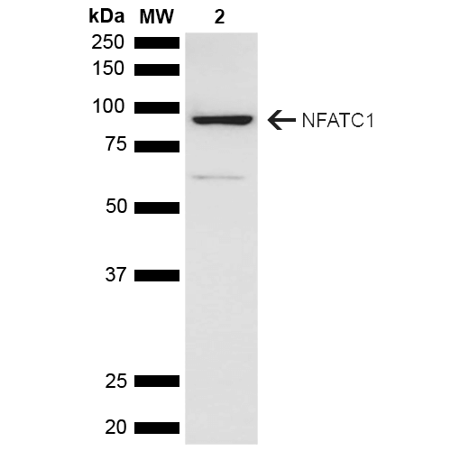 NFATC1 / NFAT2 Antibody - Western blot analysis of Rat brain lysate showing detection of ~101.2 kDa NFATC1 protein using Rabbit Anti-NFATC1 Polyclonal Antibody. Lane 1: Molecular Weight Ladder (MW). Lane 2: Rat brain lysate. Load: 15 µg. Block: 5% Skim Milk in 1X TBST. Primary Antibody: Rabbit Anti-NFATC1 Polyclonal Antibody  at 1:1000 for 2 hours at RT. Secondary Antibody: Goat Anti-Rabbit HRP:IgG at 1:3000 for 1 hour at RT. Color Development: ECL solution for 5 min at RT. Predicted/Observed Size: ~101.2 kDa. Other Band(s): ~60 kDa isoform.