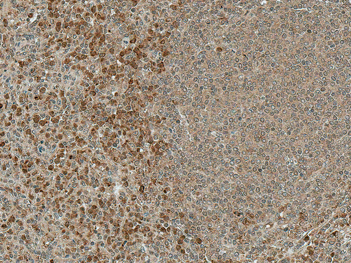 NFATC1 / NFAT2 Antibody - Immunohistochemistry analysis using Rabbit Anti-NFATC1 Polyclonal Antibody. Tissue: Spleen. Species: Human. Fixation: Formalin Fixed Paraffin-Embedded. Primary Antibody: Rabbit Anti-NFATC1 Polyclonal Antibody  at 1:50 for 30 min at RT. Counterstain: Hematoxylin. Magnification: 10X.