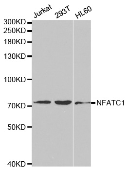 NFATC1 / NFAT2 Antibody - Western blot analysis of extracts of various cell lines, using NFATC1 antibody.