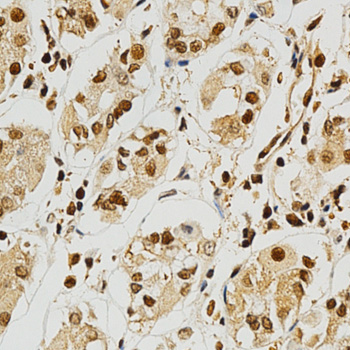 NFATC1 / NFAT2 Antibody - Immunohistochemistry of paraffin-embedded human stomach using NFATC1 antibody at dilution of 1:200 (x400 lens).