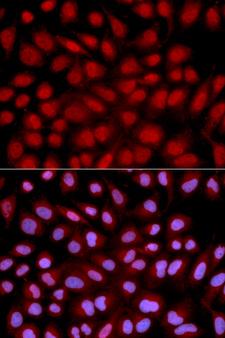 NFATC1 / NFAT2 Antibody - Immunofluorescence analysis of U2OS cell using NFATC1 antibody. Blue: DAPI for nuclear staining.