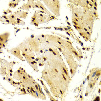 NFATC1 / NFAT2 Antibody - Immunohistochemistry of paraffin-embedded Human esophageal tissue.