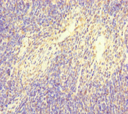 NFATC1 / NFAT2 Antibody - Immunohistochemistry of paraffin-embedded human pancreatic tissue at dilution of 1:100