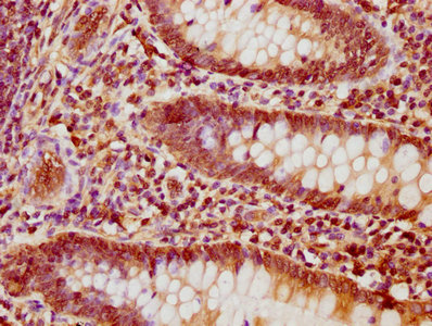 NFATC1 / NFAT2 Antibody - IHC image of NFATC1 Antibody diluted at 1:1200 and staining in paraffin-embedded human appendix tissue performed on a Leica BondTM system. After dewaxing and hydration, antigen retrieval was mediated by high pressure in a citrate buffer (pH 6.0). Section was blocked with 10% normal goat serum 30min at RT. Then primary antibody (1% BSA) was incubated at 4°C overnight. The primary is detected by a biotinylated secondary antibody and visualized using an HRP conjugated SP system.