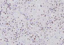 NFATC1 / NFAT2 Antibody - 1:100 staining human liver tissue by IHC-P. The sample was formaldehyde fixed and a heat mediated antigen retrieval step in citrate buffer was performed. The sample was then blocked and incubated with the antibody for 1.5 hours at 22°C. An HRP conjugated goat anti-rabbit antibody was used as the secondary.