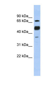 NFATC1 / NFAT2 Antibody - NFATC1 antibody Western blot of Fetal Stomach lysate. This image was taken for the unconjugated form of this product. Other forms have not been tested.