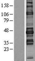 NFATC1 / NFAT2 Protein - Western validation with an anti-DDK antibody * L: Control HEK293 lysate R: Over-expression lysate