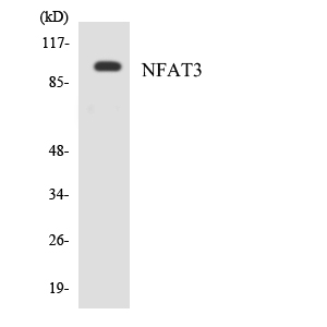 NFATC4 / NFAT3 Antibody - Western blot analysis of the lysates from COLO205 cells using NFAT3 antibody.
