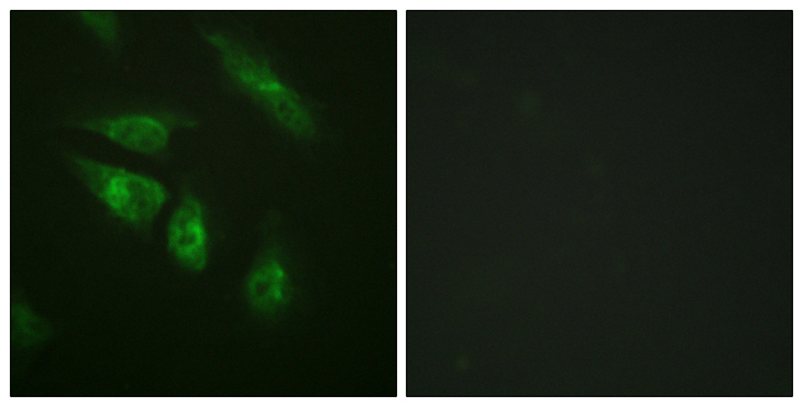 NFATC4 / NFAT3 Antibody - Immunofluorescence analysis of HeLa cells, using NFAT3 Antibody. The picture on the right is blocked with the synthesized peptide.