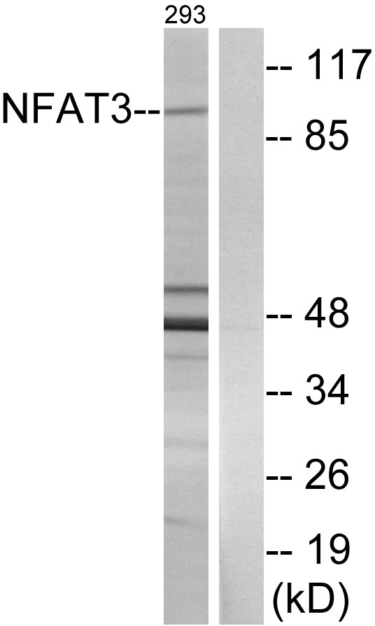 NFATC4 / NFAT3 Antibody - Western blot analysis of lysates from 293 cells, using NFAT3 Antibody. The lane on the right is blocked with the synthesized peptide.