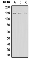 NFATC4 / NFAT3 Antibody - Western blot analysis of NFAT3 expression in A549 (A); MCF7 (B); HeLa (C) whole cell lysates.