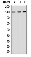 NFATC4 / NFAT3 Antibody - Western blot analysis of NFAT3 expression in Jurkat (A); K562 (B); MCF7 (C) whole cell lysates.