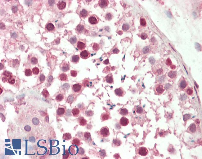 NFATC4 / NFAT3 Antibody - Human, Testis: Formalin-Fixed Paraffin-Embedded (FFPE).  This image was taken for the unconjugated form of this product. Other forms have not been tested.