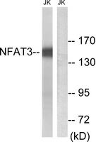 NFATC4 / NFAT3 Antibody - Western blot analysis of extracts from Jurkat cells, using NFAT3 (Ab-168/170) antibody.