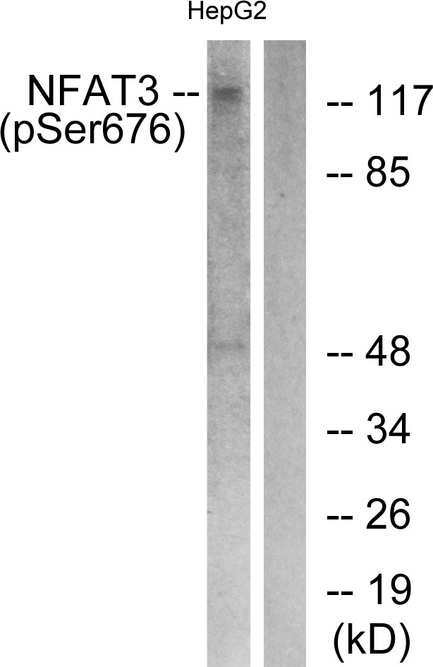 NFATC4 / NFAT3 Antibody - Western blot analysis of lysates from HepG2 cells treated with Ca2+ 40uM 30', using NFAT3 (Phospho-Ser676) Antibody. The lane on the right is blocked with the phospho peptide.