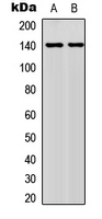 NFATC4 / NFAT3 Antibody - Western blot analysis of NFAT3 (pS676) expression in MCF7 (A); HeLa (B) whole cell lysates.