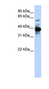 NFE2 / p45 Antibody - NFE2 antibody Western blot of 293T cell lysate. This image was taken for the unconjugated form of this product. Other forms have not been tested.