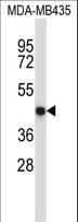 NFE2 / p45 Antibody - NFE2 Antibody western blot of MDA-MB435 cell line lysates (35 ug/lane). The NFE2 antibody detected the NFE2 protein (arrow).