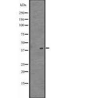 NFE2 / p45 Antibody - Western blot analysis of NFE2 expression in 293T cells lysate. The lane on the left is treated with the antigen-specific peptide.