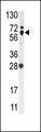 NFE2L2 / NRF2 Antibody - Western blot of anti-NFE2L2 Antibody in Ramos cell line lysates (35 ug/lane). Nrf2(arrow) was detected using the purified antibody.