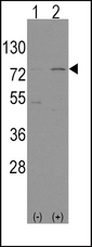NFE2L2 / NRF2 Antibody - Western blot of Nrf2(Nfe2l2)(arrow) using rabbit polyclonal Nrf2(Nfe2l2) Antibody. 293 cell lysates (2 ug/lane) either nontransfected (Lane 1) or transiently transfected with the Nrf2(Nfe2l2) gene (Lane 2) (Origene Technologies).