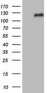 NFE2L2 / NRF2 Antibody - HEK293T cells were transfected with the pCMV6-ENTRY control (Left lane) or pCMV6-ENTRY NFE2L2 (Right lane) cDNA for 48 hrs and lysed. Equivalent amounts of cell lysates (5 ug per lane) were separated by SDS-PAGE and immunoblotted with anti-NFE2L2.