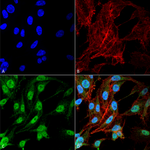 NFE2L2 / NRF2 Antibody - Immunocytochemistry/Immunofluorescence analysis using Rabbit Anti-NRF2 Polyclonal Antibody. Tissue: Colon carcinoma cell line (RKO). Species: Human. Fixation: 4% Formaldehyde for 15 min at RT. Primary Antibody: Rabbit Anti-NRF2 Polyclonal Antibody  at 1:100 for 60 min at RT. Secondary Antibody: Goat Anti-Rabbit ATTO 488 at 1:100 for 60 min at RT. Counterstain: Phalloidin Texas Red F-Actin stain; DAPI (blue) nuclear stain at 1:1000, 1:5000 for 60 min at RT, 5 min at RT. Localization: Cytoplasm, Cytosol, Nucleus. Magnification: 60X. (A) DAPI nuclear stain. (B) Phalloidin Texas Red F-Actin stain. (C) NRF2 Antibody. (D) Composite.