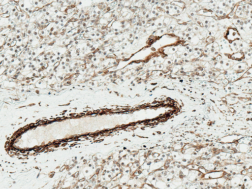 NFE2L2 / NRF2 Antibody - Immunohistochemistry analysis using Rabbit Anti-NRF2 Polyclonal Antibody. Tissue: Kidney. Species: Human. Fixation: Formalin Fixed Paraffin-Embedded. Primary Antibody: Rabbit Anti-NRF2 Polyclonal Antibody  at 1:50 for 30 min at RT. Counterstain: Hematoxylin. Magnification: 20X.