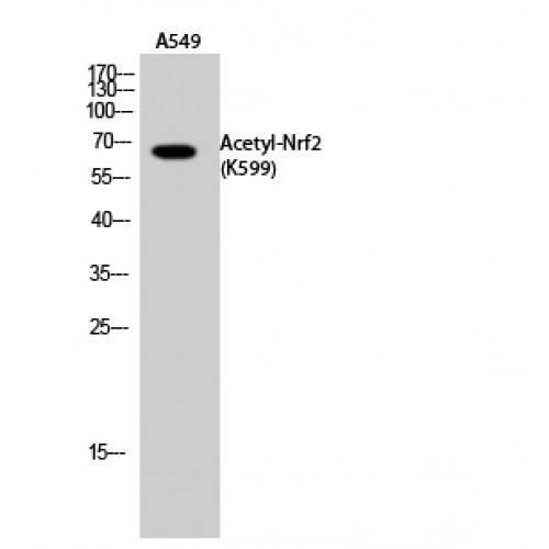 NFE2L2 / NRF2 Antibody - Western blot of Acetyl-Nrf2 (K599) antibody