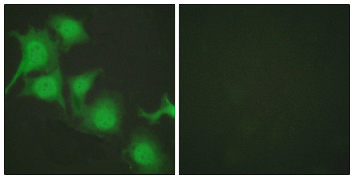 NFE2L2 / NRF2 Antibody - Immunofluorescence analysis of HUVEC cells, using Nrf2 Antibody. The picture on the right is blocked with the synthesized peptide.