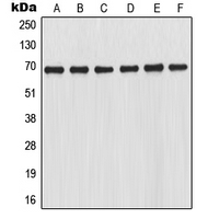 NFE2L2 / NRF2 Antibody - Western blot analysis of NRF2 expression in THP1 (A); HL60 (B); K562 (C); Jurkat (D); mouse kidney (E); rat kidney (F) whole cell lysates.