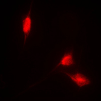 NFE2L2 / NRF2 Antibody - Immunofluorescent analysis of NRF2 staining in HL60 cells. Formalin-fixed cells were permeabilized with 0.1% Triton X-100 in TBS for 5-10 minutes and blocked with 3% BSA-PBS for 30 minutes at room temperature. Cells were probed with the primary antibody in 3% BSA-PBS and incubated overnight at 4 C in a humidified chamber. Cells were washed with PBST and incubated with a DyLight 594-conjugated secondary antibody (red) in PBS at room temperature in the dark. DAPI was used to stain the cell nuclei (blue).